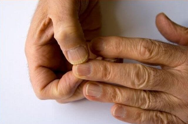 Close-up of nails showing discoloration nail health and care  by nailbeautyguide